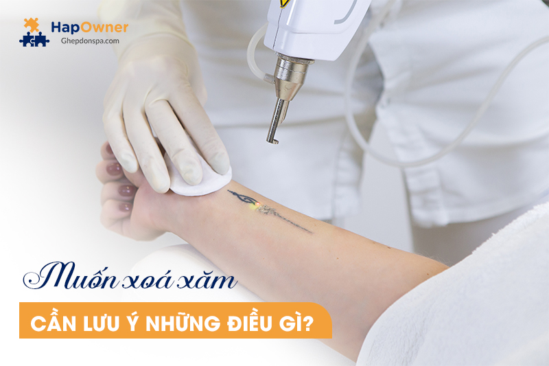 Muốn xóa xăm cần lưu ý những gì?